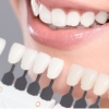 Zahnbleaching - Zahnarzt Altötting